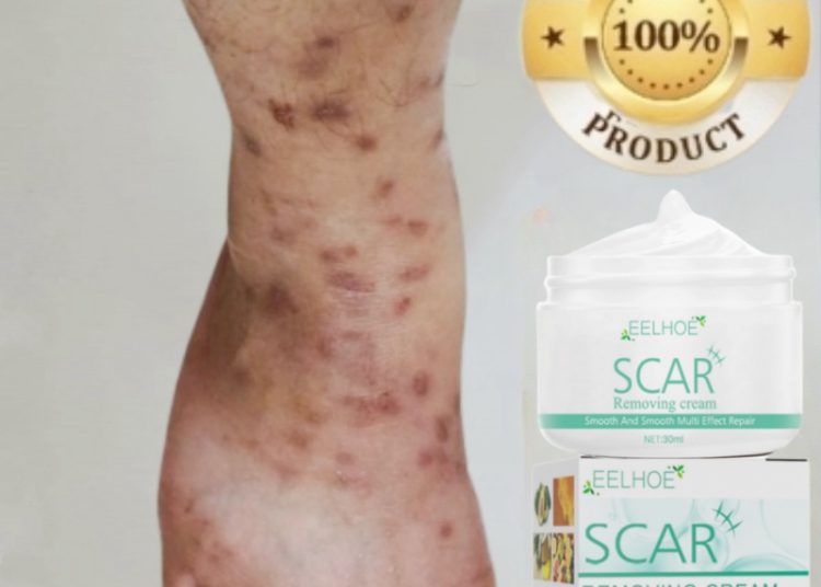 Skandal Ibu Manohara Ilmu Hitam dan Luka Lama Terbongkar – Aksara Lokal Skandal Ibu Manohara: Ilmu Hitam dan Luka Lama Terbongkar!