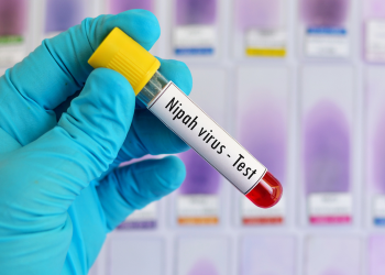 Virus Nipah India: Ancaman Maut yang Wajib Anda Tahu!