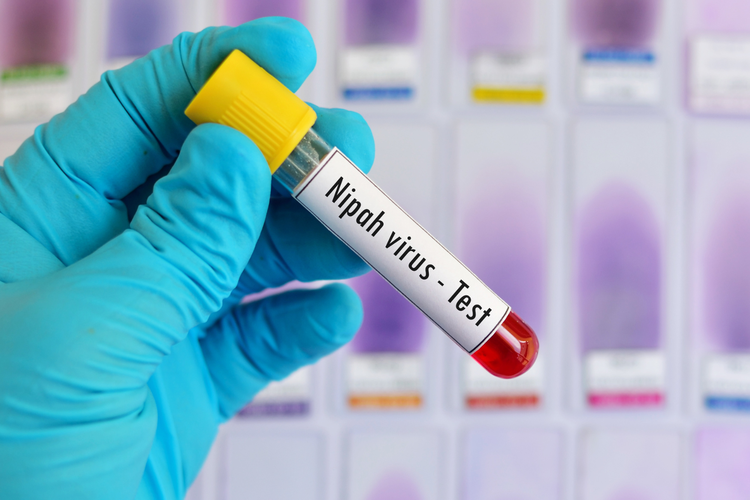 Virus Nipah India Ancaman Maut yang Wajib Anda Tahu – Aksara Lokal Virus Nipah India: Ancaman Maut yang Wajib Anda Tahu!