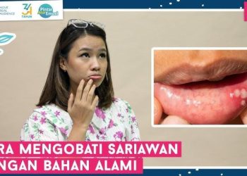 Chelsea Olivia Alami Bibir Bengkak Usai 4 Operasi di Malaysia